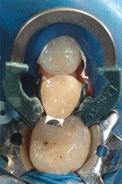 1610degoo P07 1610degoo P07