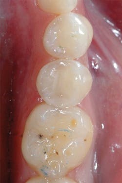 1610degoo P08 1610degoo P08