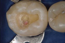 1611dechr P01 1611dechr P01