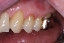 1611depla P01 1611depla P01