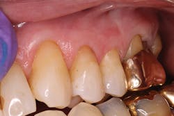 1611depla P02 1611depla P02