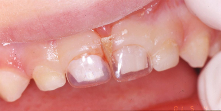 1611desan P01