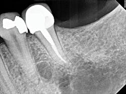 1701decaz P05 1701decaz P05