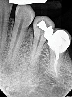 1701decaz P06 1701decaz P06