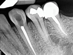 1701decaz P07 1701decaz P07