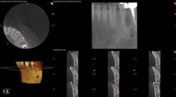 1701decaz P08 1701decaz P08