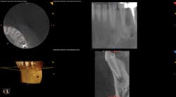 1701decaz P09 1701decaz P09