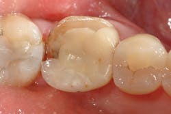 1701degoo P02 1701degoo P02