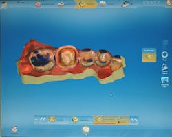 1701degoo P04 1701degoo P04