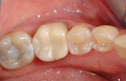 1701degoo P05 1701degoo P05