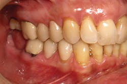 1701degoo P06 1701degoo P06