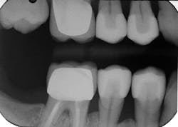 1701degoo P07 1701degoo P07