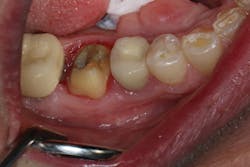 1701dekim P01 1701dekim P01