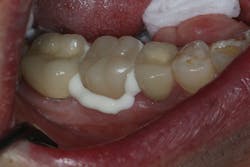 1701dekim P03 1701dekim P03