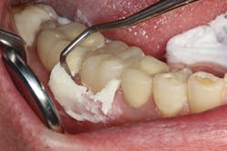 1701dekim P04 1701dekim P04