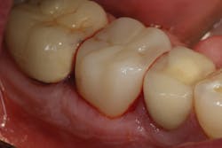 1701dekim P05 1701dekim P05