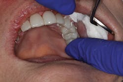 1701dekim P10 1701dekim P10