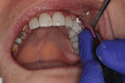 1701dekim P11 1701dekim P11