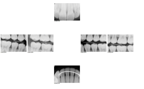 1701demck P01