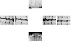 1701demck P01