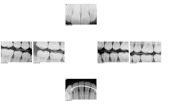 1701demck P01 1701demck P01