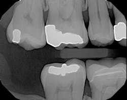 1701demck P05 1701demck P05