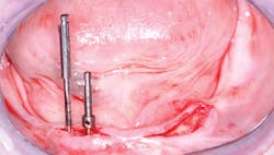 1702dechr P02 1702dechr P02