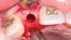 1702dechr P03 1702dechr P03