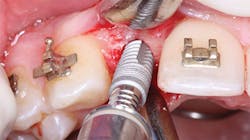 1702dechr P04 1702dechr P04