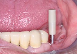 1702dechr P06a 1702dechr P06a