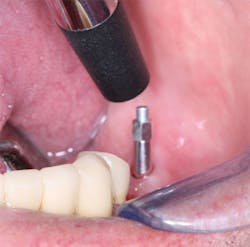 1702dechr P07a 1702dechr P07a