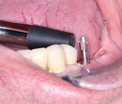 1702dechr P07b 1702dechr P07b