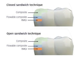 1703de 581 1703de 581