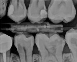 1703deshu P03 1703deshu P03