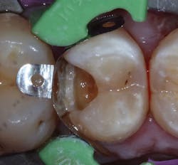 1703deshu P05 1703deshu P05