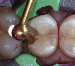 1703deshu P06 1703deshu P06