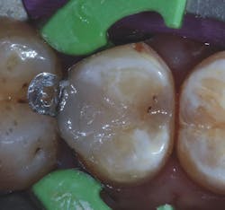 1703deshu P10 1703deshu P10