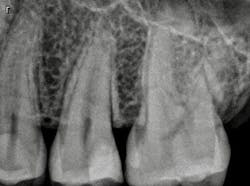 1703deshu P12 1703deshu P12