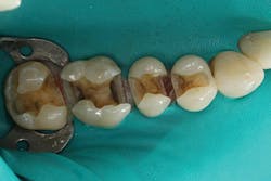 Ivoclar 1606deses P02 scale large png Ivoclar 1606deses P02 scale large png