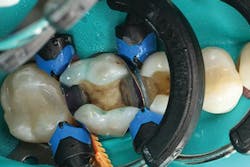 Ivoclar 1606deses P03 scale large png Ivoclar 1606deses P03 scale large png