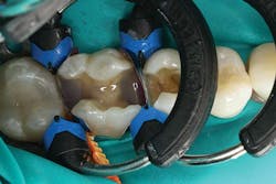 Ivoclar 1606deses P04 scale large png Ivoclar 1606deses P04 scale large png