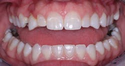 1704dechr P01 1704dechr P01