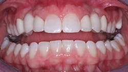 1704dechr P03 1704dechr P03