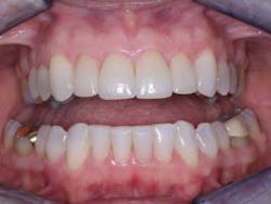 1704dechr P06 1704dechr P06