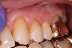 Ivoclar 05 2017 Image2 Ivoclar 05 2017 Image2