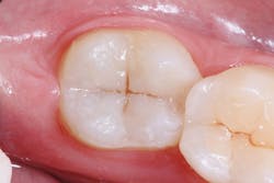 1705dehir P06 1705dehir P06