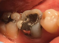 1705demal P01 1705demal P01