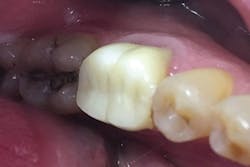 1705demal P02 1705demal P02