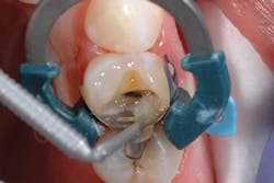 1705derho P03 1705derho P03