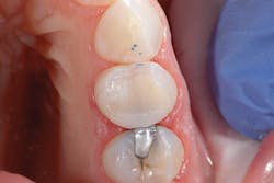 1705derho P04 1705derho P04